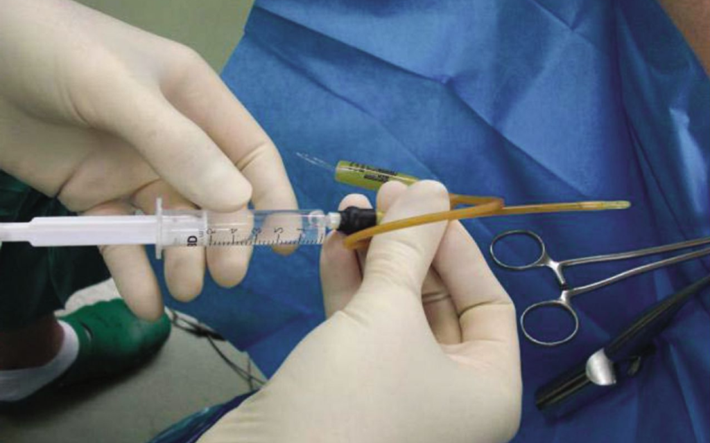 Chromopertubation in Jayanagar