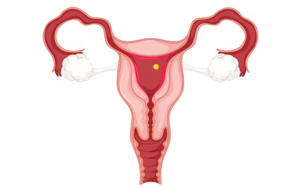 Endometriosis Treatment in Jayanagar
