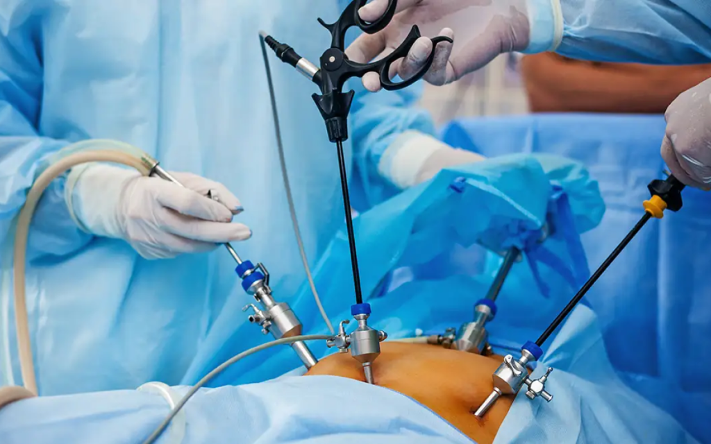 Laparoscopic Gynaecology in Jayanagar